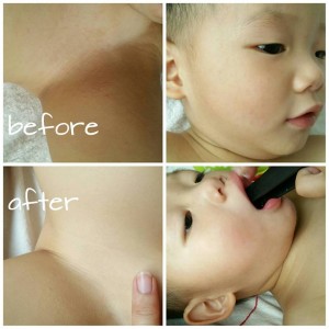 super soothing cream before after